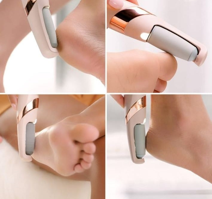 Rechargeable Electric Foot Callus Remover – Smooth, Soft &amp; Healthy Feet at Home
