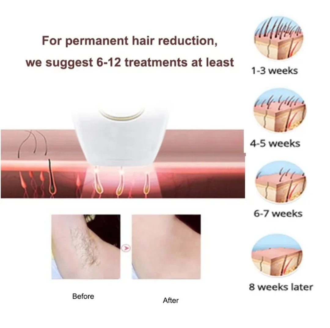 IPL Laser Hair Removal Device for Men & Women with Razor & Safety Glasses